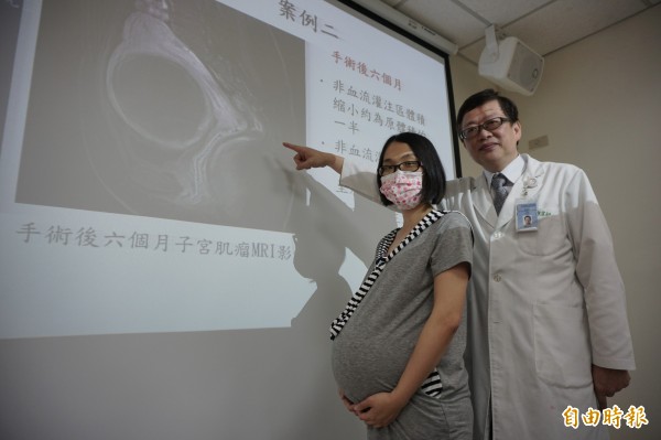 醫師應宗利用海扶刀消融林小姐的大型子宮肌瘤，現在她懷孕37週將生產當媽媽。（記者蔡淑媛攝）