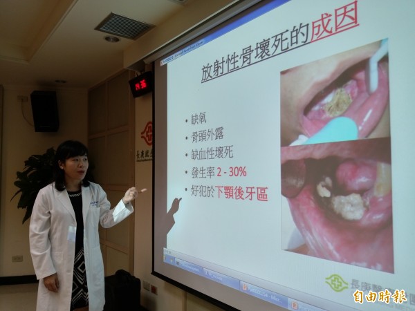 黃意方提醒,頭頸癌患者在做放射性治療之前,先接受洗牙和塗氟的預防性照護,可降低放射性骨壞死的機率。(記者吳亮儀攝)