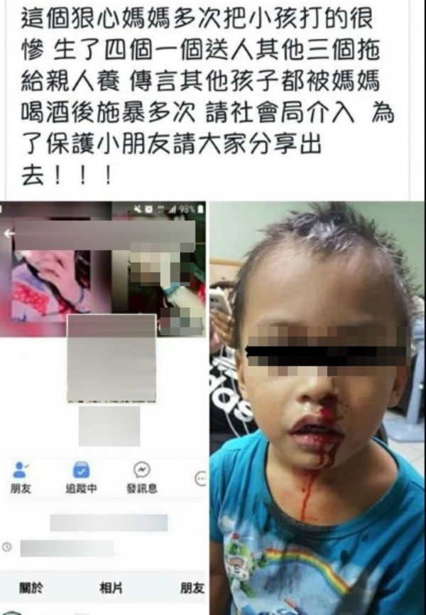 一位民眾將4歲男童流鼻血的照片貼上臉書《爆料公社》，指控男童母親酒後常對小孩施虐。（記者陳建志翻攝臉書爆料公社）