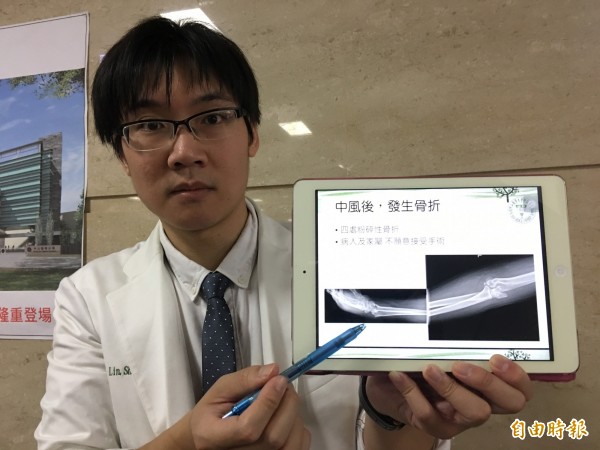 醫師林聖傑指出,這名52歲中風患者跌倒後造成手腕、手肘粉碎性骨折。(記者蔡淑媛攝)