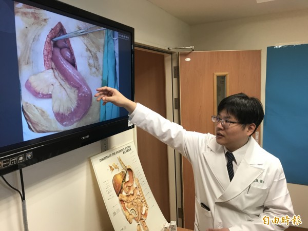 台中慈濟醫院一般外科主任余政展指著患者腸阻塞部位,說明病情。(記者李忠憲攝)