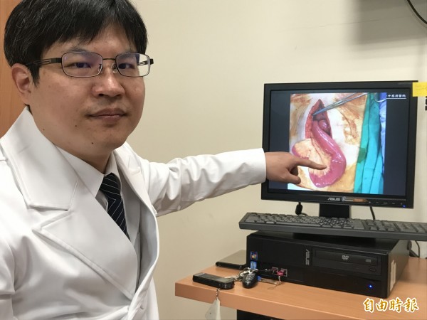 台中慈濟醫院一般外科主任余政展指著患者腸阻塞部位,說明病情。(記者李忠憲攝)