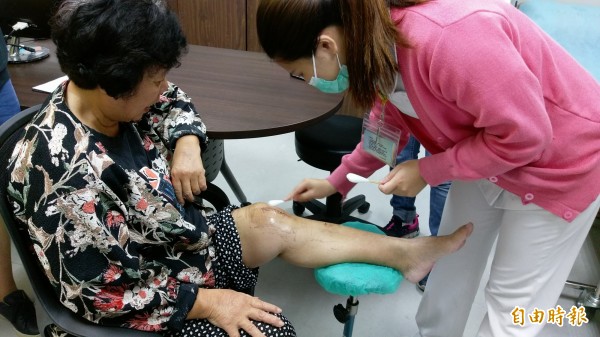 婦人因工作重複蹲站造成膝蓋提早受損，接受機器人手臂關節手術治療康復（記者蘇金鳳攝）