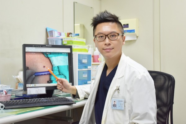醫師籲「黑痣」別亂點!男子誤認長痣,尋求雷射點「痣」,竟是基底細胞癌。(圖:澄清提供)