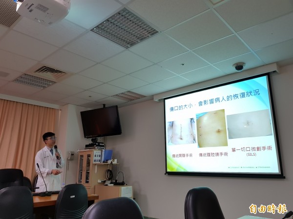 55歲中年婦女因長期腹脹至柳營奇美醫院求診,證實為大腸惡性腫瘤,柳營奇美醫院一般及消化系外科主治醫師陳憲霖透過微創單孔手術取出腫瘤,患者恢復迅速。 (記者王涵平攝)