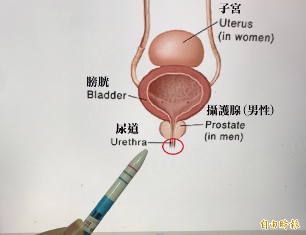 烏日林新醫院感染科主任郭正邦表示,「憋尿」容易造成膀胱尿液囤積、細菌繁殖,提高泌尿道感染機率。(記者陳建志攝)