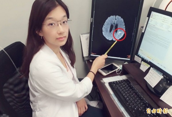 陳惠萱醫師提醒,梗塞性腦中風症狀和失智類似,民眾要儘快就醫保握黃金治療期。(記者陳建志攝)