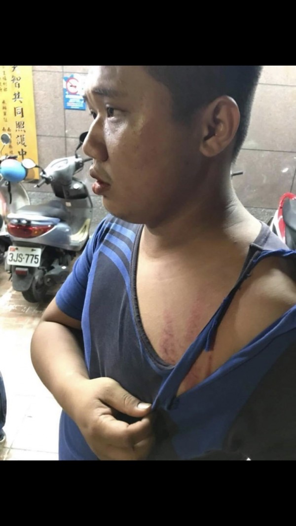 漁會人員拉扯中也受傷。(記者蔡宗憲翻攝)