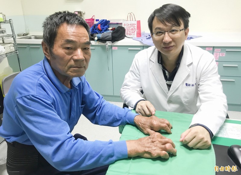 台中一名69歲林姓男子(左),因先天體質加上喜歡吃海鮮、火鍋,尿酸過高手指關節長滿痛風石,林剛民主任(右)提醒需按時服藥控制尿酸。(記者陳建志攝)