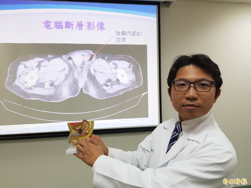 83歲老翁長期卧床,因腹側腫脹送醫,柳營奇美醫院泌尿外科主治醫師邱毅平確診為佛尼爾氏壞死症,未接受壞死組織清創,僅施以抗生素,住院4日後不幸過世。 (記者王涵平攝)