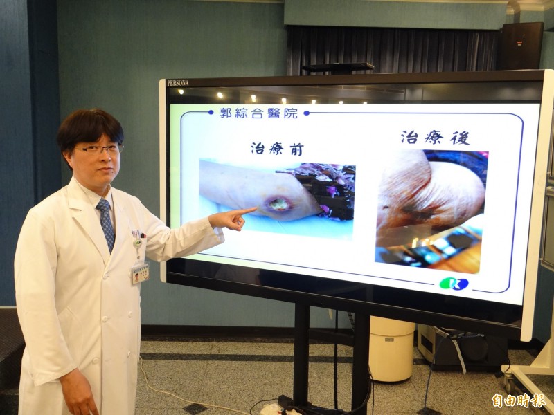 郭綜合醫院感染內科主任鍾志桓醫師提醒做醫美手術、植入、刺青等侵入性處置,須有完善消毒清潔措施,避免感染發生。(記者王俊忠攝)