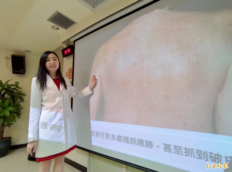 吳吉妮說,若接受免疫療法的病患皮膚出現副作用,代表免疫療法有療效,而這些皮膚副作用經治療可有效改善。(記者吳亮儀攝)