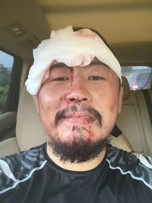 徐曉冬這次被打趴。(圖擷自網路)