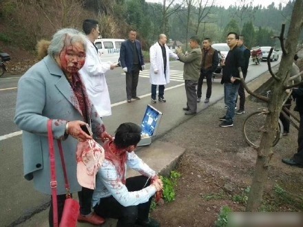 受傷乘客臉上掛血，站在路邊等待救援。（圖擷取自新浪微博）