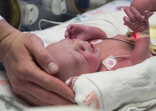 美國德州一名先天無子宮的女性，經子宮移植手術後，順利產下一名健康的嬰兒，這也是全美首件成功案例。（美聯社）
