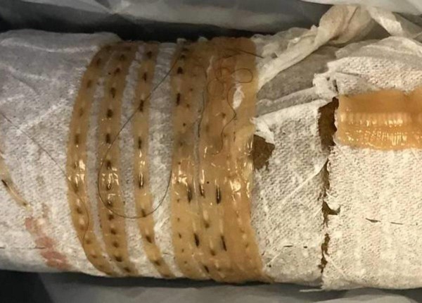 美國男疑因酷愛生吃鮭魚,導致感染寄生蟲,如廁時竟拉出一條1.6公尺長的絛蟲。(圖擷自AOL)