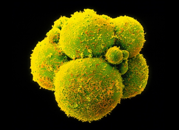 CRISPR/Cas9 技術又可以叫做「基因編輯」(gene editing),主要是利用一種複合酶(俗稱「基因剪刀」)來剪去缺陷基因,再以好的基因補上。(翻攝自網路)