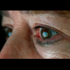 Google Glass 過時了!最新科技是直接植入眼睛! Google Glass 過時了!最新科技是直接植入眼睛!