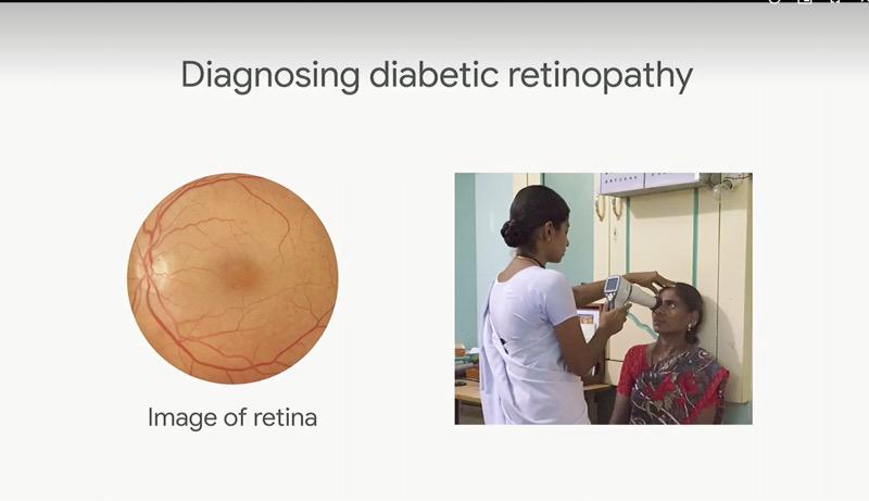 Google AI 開始能協助診斷糖尿病（圖／翻攝自 Google 官網）