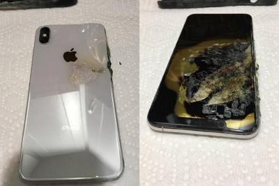 全球首例!美國男因 iPhone XS Max 爆炸導致燒傷 全球首例!美國男因 iPhone XS Max 爆炸導致燒傷