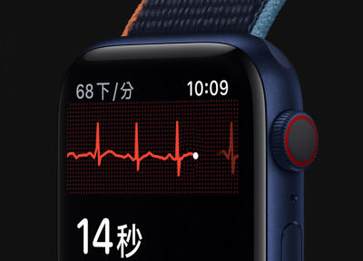 Apple Watch 心電圖「抓心律不整」有用!台醫師分享實際病例 Apple Watch 心電圖「抓心律不整」有用!台醫師分享實際病例