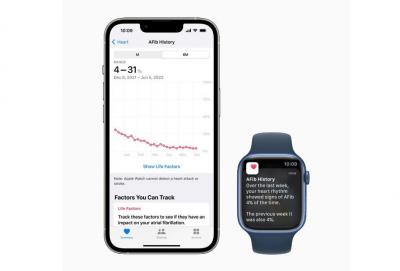 Apple Watch 心房顫動紀錄功能獲美國FDA 健康技術認證!可用於臨床研究 Apple Watch 心房顫動紀錄功能獲美國FDA 健康技術認證!可用於臨床研究
