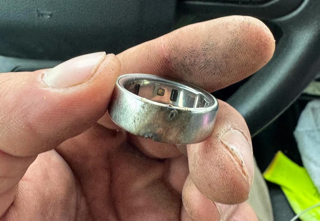 一名國外網友分享，自己的Oura智慧戒指因莫名過熱而出現燒焦痕跡。（圖／Reddit）
