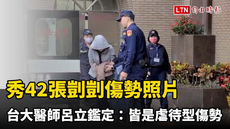 29日秀42張剴剴傷勢照片 台大醫師呂立鑑定:皆是虐待型傷勢 29日秀42張剴剴傷勢照片 台大醫師呂立鑑定:皆是虐待型傷勢