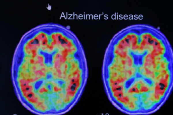 站起來救大腦！ 研究：久坐恐增失智風險 運動也難抵銷