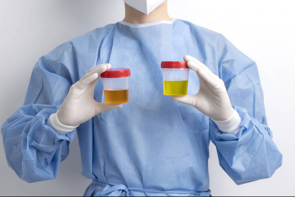 看到尿有泡就崩潰 醫教你一秒判斷 一堆人搞錯