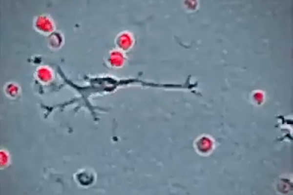 中年減肥要注意！小鼠實驗顯示：雖改善血糖卻伴隨腦部發炎