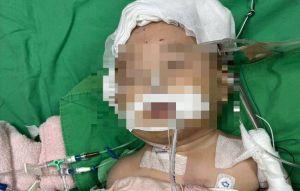 台中女嬰腦傷開顱5次 保母測謊未過卻不起訴家屬不服