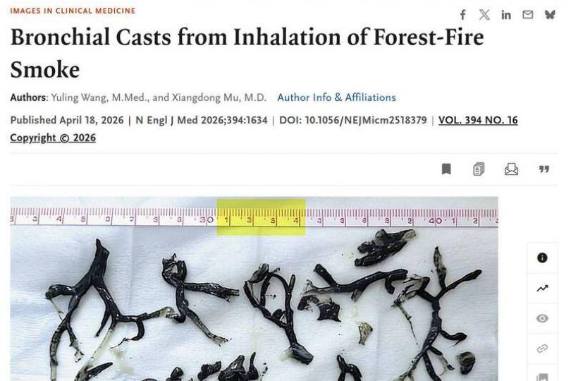 中國醫師投國際醫學期刊 用AI圖露餡火速被撤稿