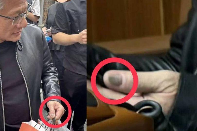 黃仁勳灰色指甲吸百萬人關注 皮膚科醫師揭真相