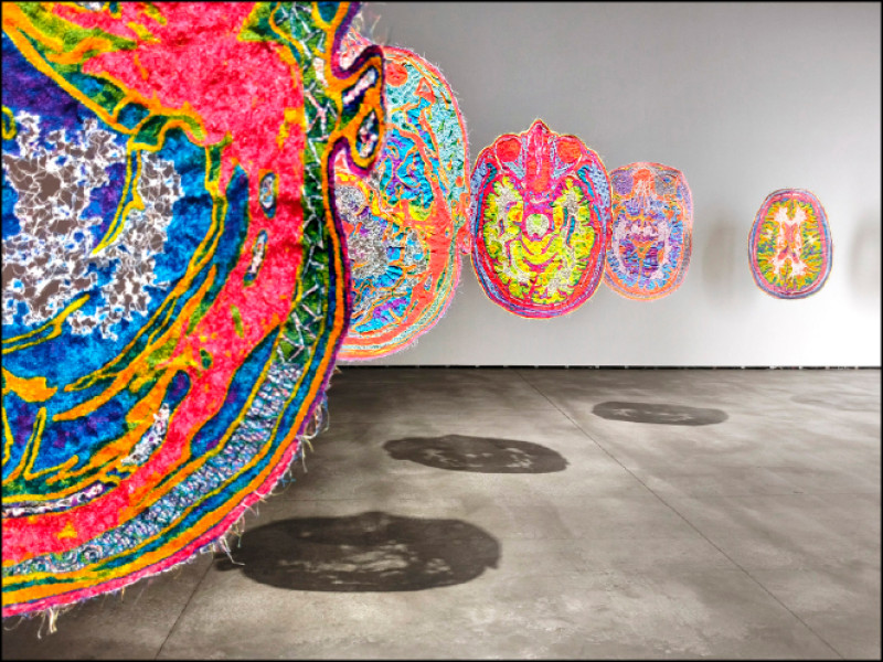 宮田彩加2016年至今作品〈MRI SM20110908〉。