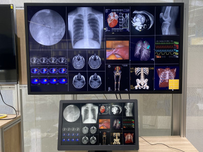 鈺緯將於醫療科技展 首度亮相Mini LED醫療顯示器