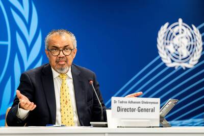 COVID-19是武漢實驗室洩漏？譚德塞不藏了 曝習近平反應