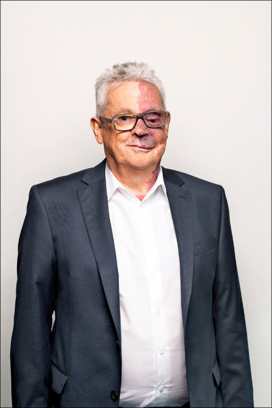 國際罕見疾病照護先驅AOP創辦人兼董事Dr. Rudolf Widmann（AOP提供）