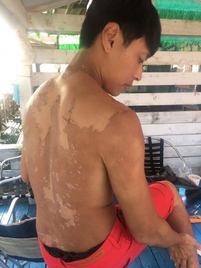 想黑帥帥跳國標 男星一曬太陽就GG