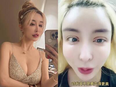 雪碧曝難言之隱！ 「不是為了變美」親揭整型原因