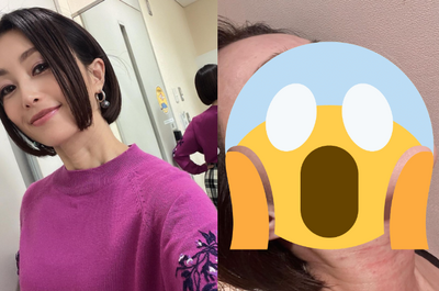 「擋泥板女神」酒井法子為保美貌施打1物! 嚇人近況網看傻