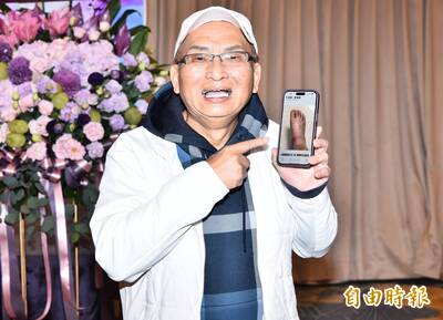 （影）孔鏘「腳腫如豬腳」查不到病因！露面曝近況最怕要截肢