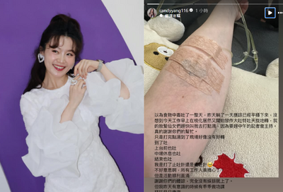 楊小黎食物中毒狂吐！「3天沒進食」曝病況：站都站不住