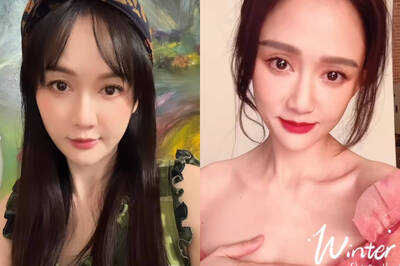 陳喬恩打電波臉腫遭酸「整成網紅臉」 氣炸反嗆網友