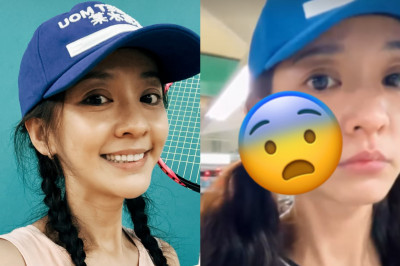 陳意涵臉突然歪了！右臉離奇腫脹急問AI求救