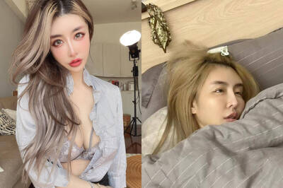 情色教主雪碧整過頭出事了 後悔苦勸粉絲：要聽醫生的