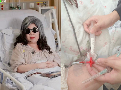 陳文茜癌症加劇再爆肺囊腫！5器官遭自體攻擊「我幾乎已無法負荷」