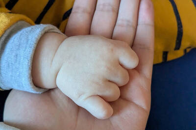 廣告小妹曝孕後「腳踝血栓」 憶：甜蜜過後是痛苦