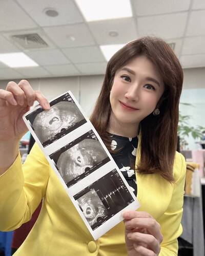 主播鄭亦真好孕藏不住 明年要當媽媽了