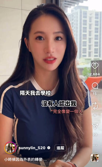 戴粉紅眼鏡、剪西瓜皮！林采緹回憶童年被霸凌過往